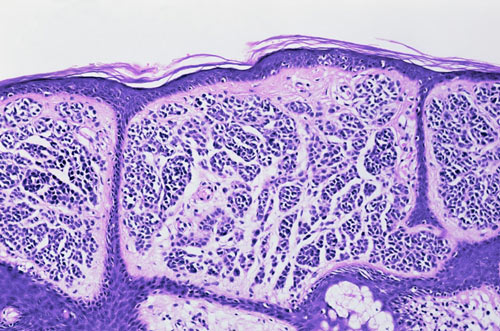 Microscopic view of skin layers protecting the body from infection