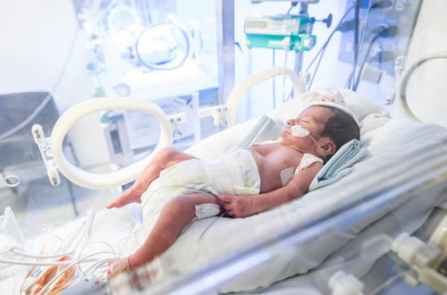 Infant on hospital bed with fragile skin