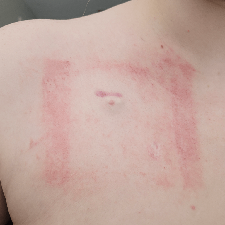 skin