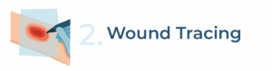 2wound tracing
