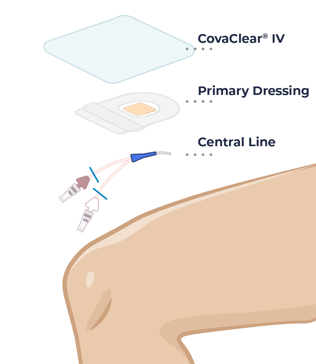leg parts 1