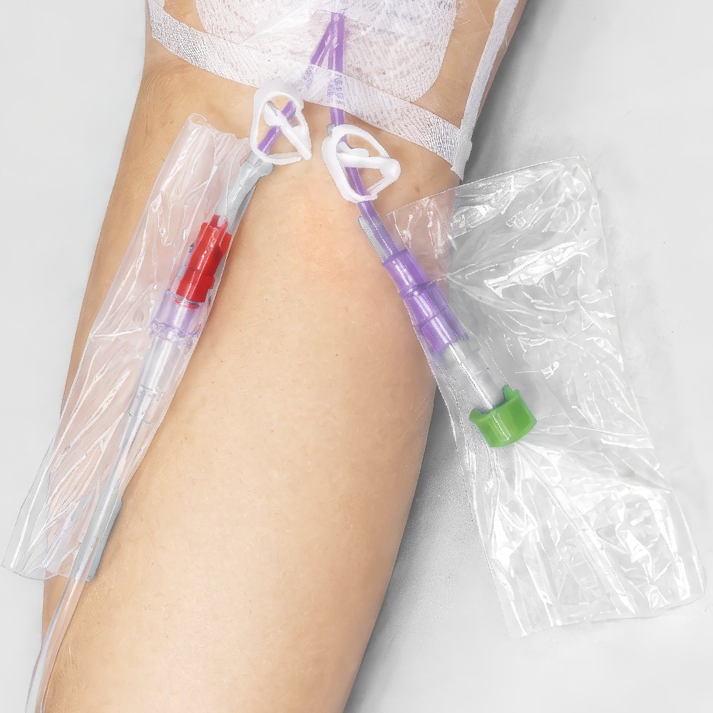 The same IV line connections and access points with VALGuard added