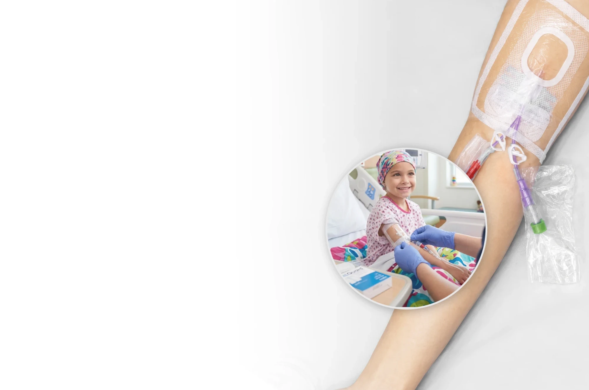 Arm with an IV site protected by a clear dressing and line guard, with an inset of a nurse caring for a smiling child